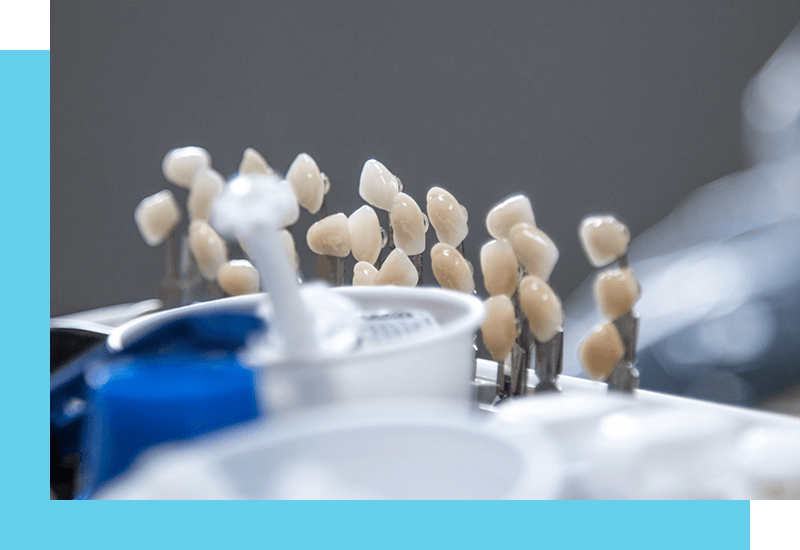 Dental crowns specialists near DeForest